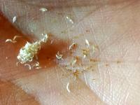 Eriocaulon seeds